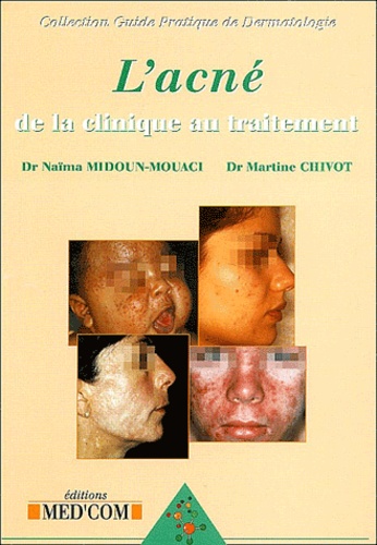 Naïma Midoun-Mouaci et Martine Chivot - L'acné : de la clinique au traitement.