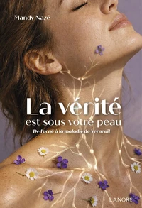 La vérité est sous votre peau ! De l'acné à la maladie de Verneuil