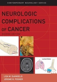 Neurologic Complications of Cancer.