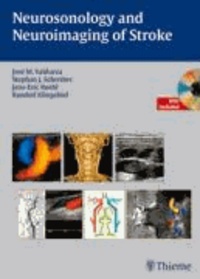 Neurosonology and Neuroimaging of Stroke - A Teaching Atlas.