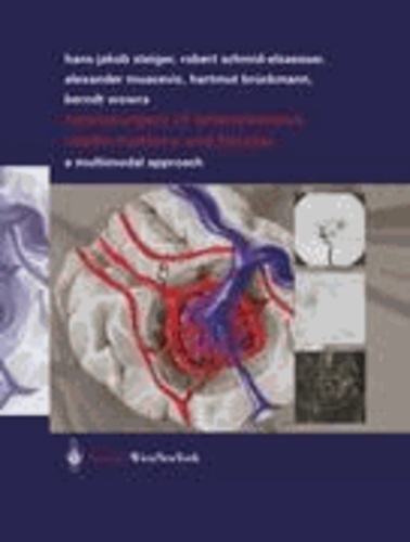 Neurosurgery of Arteriovenous Malformations and Fistulas - A Multimodal Approach.