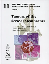 Tumors of the Serosal Membranes