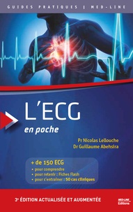 Livres gratuits à télécharger sur tablette L'ECG en poche par Nicolas Lellouche, Guillaume Abehsira 9782846782753 