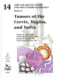 Tumors of the Cervix, Vagina, and Vulva