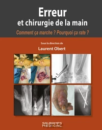Erreur et chirurgie de la main