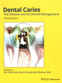 Dental Caries