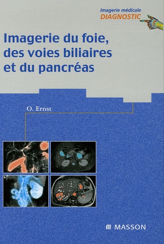 Olivier Ernst - Imagerie du foie, des voies biliaires et du pancréas.