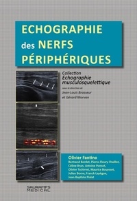 Olivier Fantino - Echographie des nerfs périphériques.