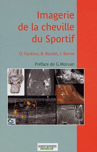 Olivier Fantino et Bertrand Bordet - Imagerie de la cheville du sportif.