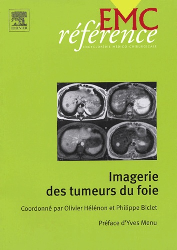 Olivier Hélénon et Philippe Biclet - Imagerie des tumeurs du foie.