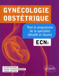 Olivier Poujade et Pierre-François Ceccaldi - Gynécologie-obstétrique - ECNi. Tout le programme de la spécialité détaillé et illustré.