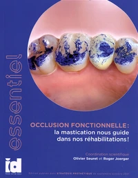 Occlusion fonctionnelle : la mastication nous guide dans nos réhabilitations !