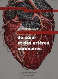 Olivier Vignaux et Denis Agostini - Imagerie du coeur et des artères coronaires.