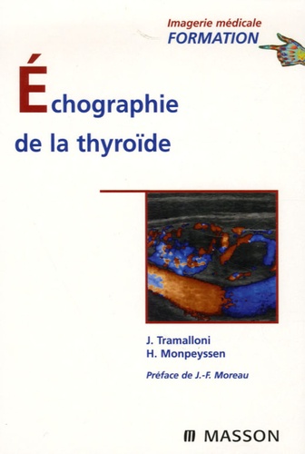Echographie De La Thyroïde