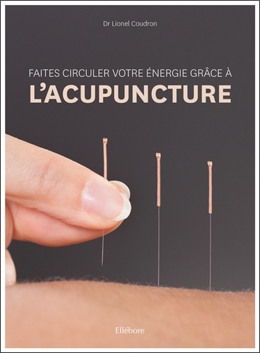 Faites Circuler Votre Énergie Grâce À L'acupuncture