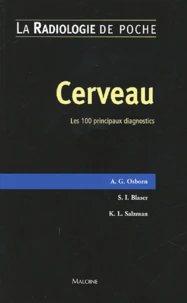 Cerveau