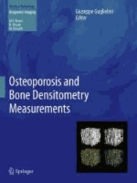 Osteoporosis and Bone Densitometry Measurements.