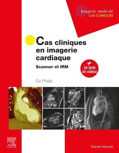 Cas cliniques en imagerie cardiaque. Scanner et IRM