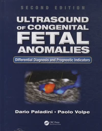 Ultrasound of Congenital Fetal Anomalies