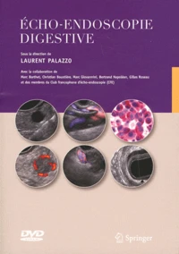 Echo-endoscopie digestive