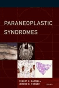Paraneoplastic Syndromes.