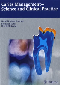 Caries Management-Science and Clinical Practice