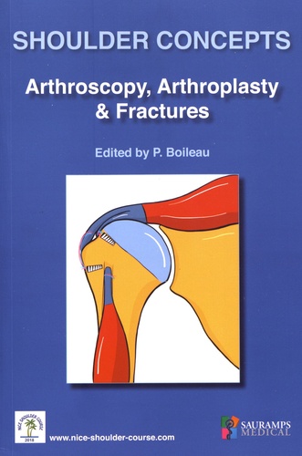 Pascal Boileau - Shoulder Concepts - Arthroscopy, Arthrosplasty & Fractures.