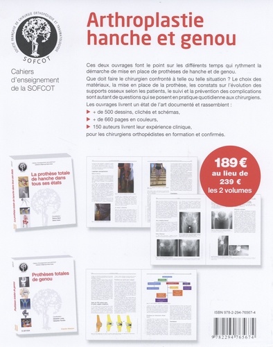 Arthroplastie hanche et genou. 2 volumes : Prothèses totales de genou ; La prothèse totale de hanche dans tous ses états