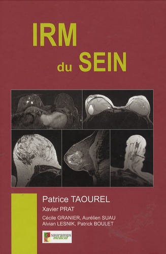 Patrice Taourel - IRM du sein.
