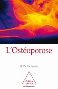 Patrick Gepner - Ostéoporose (L').