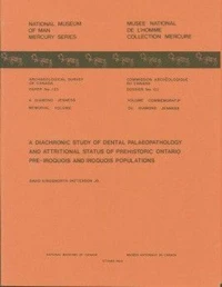 Diachronic Study of Dental Palaeopathology and Attritional Status of Prehistoric Ontario Pre-Iroquois and Iroquois Populations