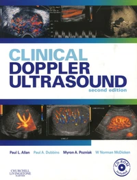 Clinical Doppler Ultrasound