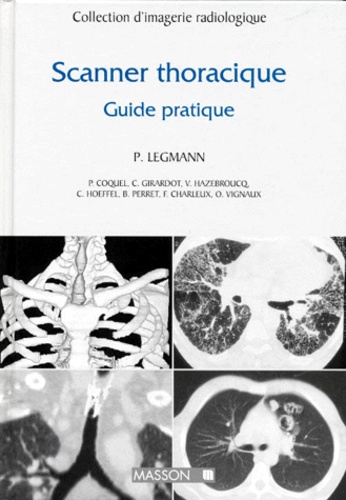 Paul Legmann - Scanner Thoracique. Guide Pratique.