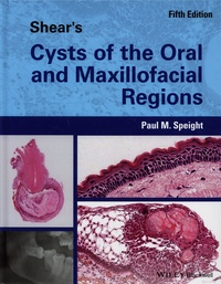 Paul M. Speight - Shear's Cysts of the Oral and Maxillofacial Regions.