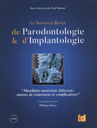 La Nouvelle Revue de Parodontologie & d'Implantologie. "Maxillaire postérieur déficient : options de traitement et complications"