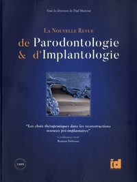 Paul Mattout - Les choix thérapeutiques dans les reconstructions osseuses pré-implantaires.