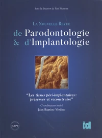 Les tissus péri-implantaires : préserver et reconstruire