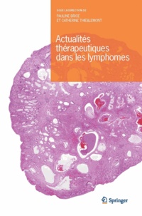 Pauline Brice et Catherine Thieblemont - Actualités thérapeutiques dans les lymphomes.