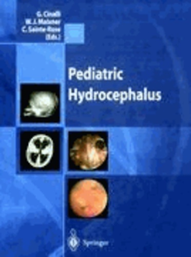 Giuseppe Cinalli - Pediatric Hydrocephalus.