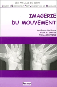 Imagerie Du Mouvement
