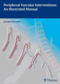 Peripheral Vascular Interventions: An Illustrated Manual