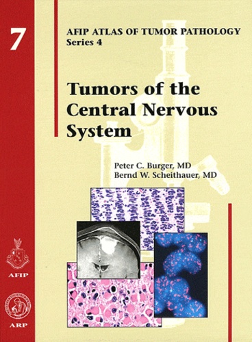 Peter C Burger et Bernd W Scheithauer - AFIP Atlas of Tumor Pathology - Fourth Series Fasicle 7, Tumors of the Central Nervous System.