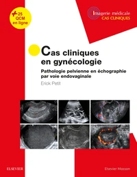 Cas cliniques en gynécologie