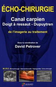 Echo-chirurgie canal carpien, doigt à ressaut - Dupuytren