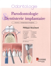 Parodontologie & dentisterie implantaire - Volume 2, Thérapeutiques chirurgicales.pdf