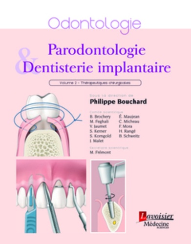 Philippe Bouchard - Parodontologie & dentisterie implantaire - Volume 2, Thérapeutiques chirurgicales.