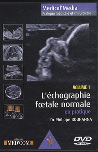 Philippe Bouhanna - L'Echographie foetale normale en pratique volume 1 - DVD vidéo.