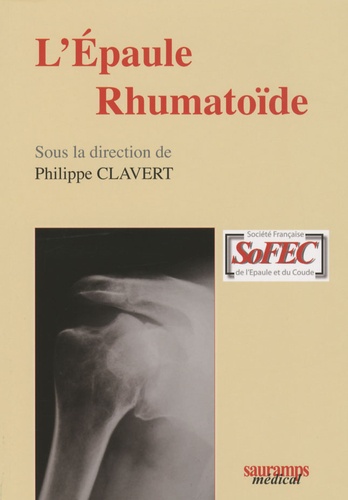 Philippe Clavert - L'épaule rhumatoïde.