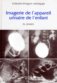 Philippe Devred - Imagerie de l'appareil urinaire de l'enfant.