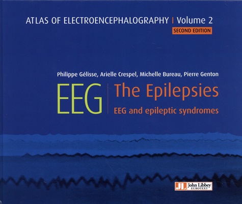 Atlas of Electroencephalography. Volume 2, The Epilepsies, EEG and Epileptic Syndromes 2nd edition